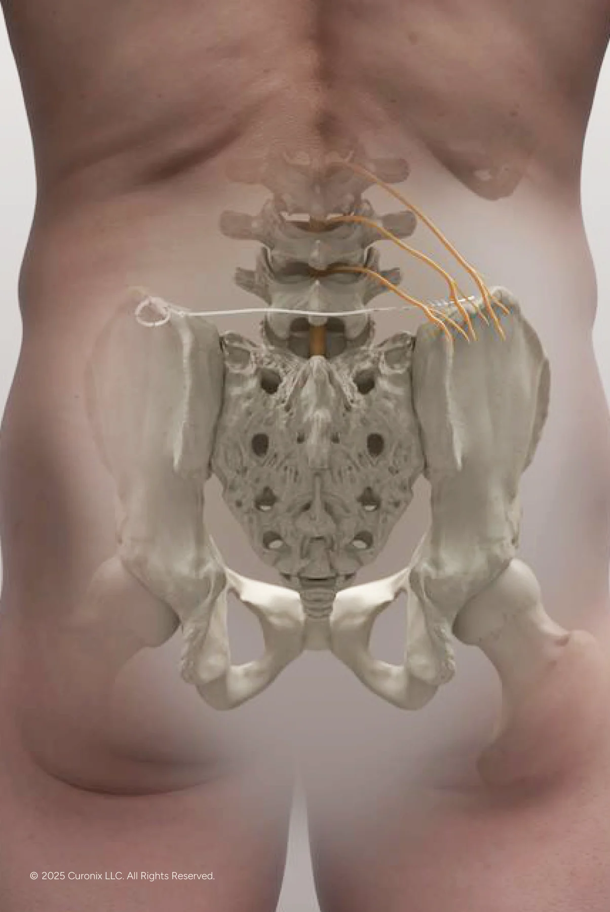 Superior Cluneal Nerve for Chronic Low Back Pain 02