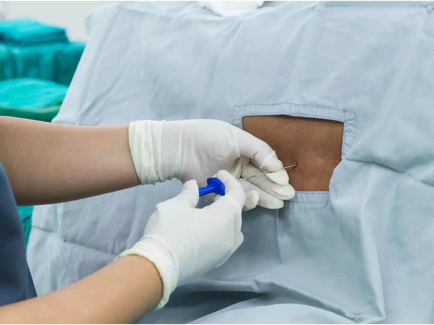 Sympathetic Nerve Blocks at Kentuckiana Pain Specialists